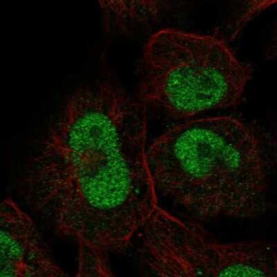 Immunocytochemistry/ Immunofluorescence: ZNF667 Antibody [NBP2-58273]
