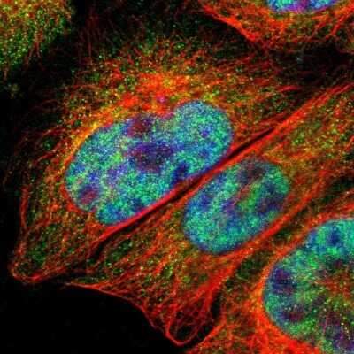 Immunocytochemistry/ Immunofluorescence: ZNF670 Antibody [NBP1-81218]