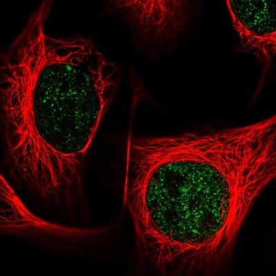 Immunocytochemistry/ Immunofluorescence: ZNF672 Antibody [NBP2-47563]