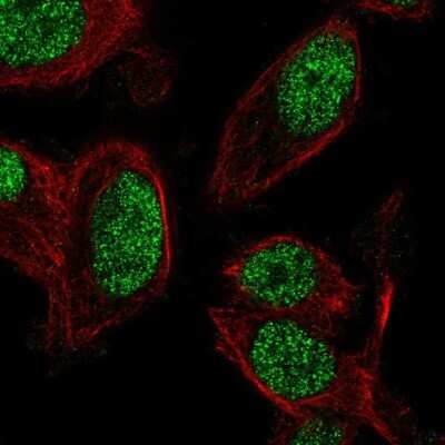 Immunocytochemistry/ Immunofluorescence: ZNF672 Antibody [NBP2-56351]
