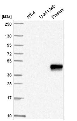 Western Blot: ZNF672 Antibody [NBP2-56351]