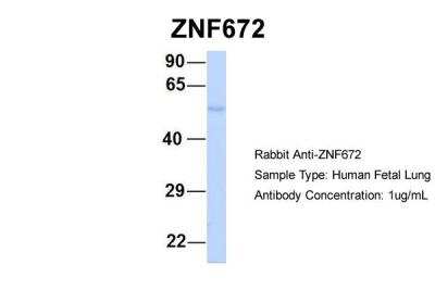 Western Blot: ZNF672 Antibody [NBP2-88726]