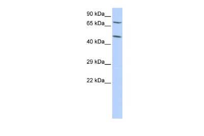 Western Blot: ZNF672 Antibody [NBP2-88727]