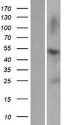 Western Blot: ZNF672 Overexpression Lysate [NBP2-06261]