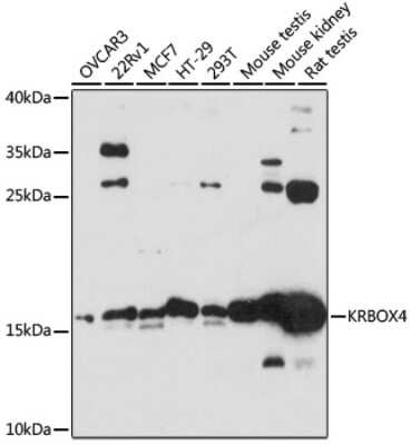 Western Blot: ZNF673 AntibodyAzide and BSA Free [NBP2-93582]