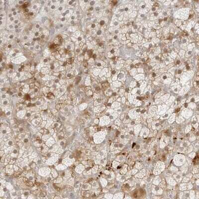 Immunohistochemistry-Paraffin: ZNF678 Antibody [NBP1-81079]