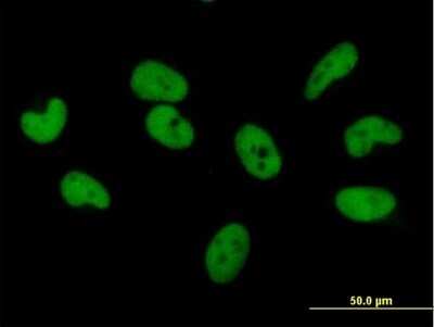 Immunocytochemistry/ Immunofluorescence: ZNF680 Antibody [H00340252-B01P]