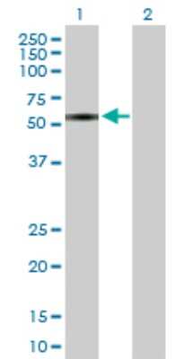Western Blot: ZNF680 Antibody [H00340252-B01P]