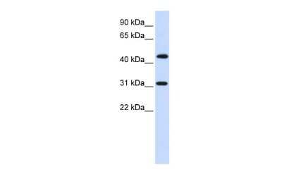 Western Blot: ZNF684 Antibody [NBP2-83890]