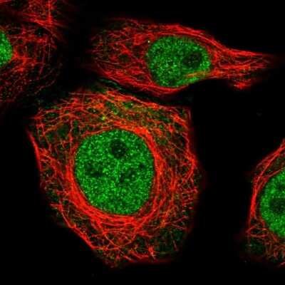 Immunocytochemistry/ Immunofluorescence: ZNF688 Antibody [NBP2-30749]