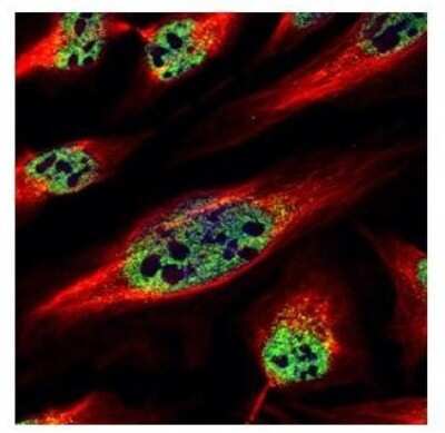 Immunocytochemistry/ Immunofluorescence: ZNF689 Antibody [NBP2-21040]
