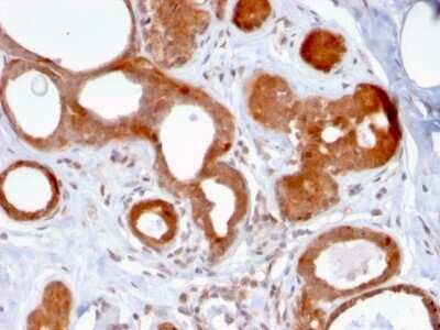 Immunohistochemistry-Paraffin: ZNF690 Antibody (ZSCAN29/2610) [NBP2-79746]