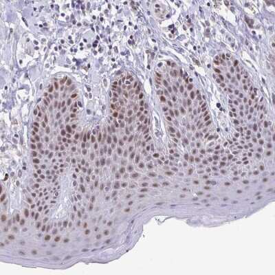 Immunohistochemistry-Paraffin: ZNF691 Antibody [NBP2-31858]