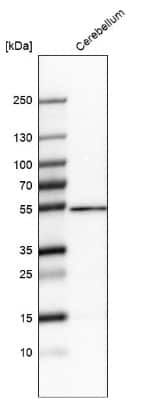 Western Blot: ZNF692 Antibody [NBP2-56800]