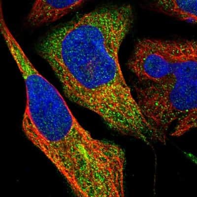 Immunocytochemistry/ Immunofluorescence: ZNF70 Antibody [NBP1-84402]