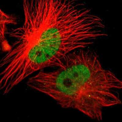 Immunocytochemistry/ Immunofluorescence: ZNF701 Antibody [NBP1-83815]