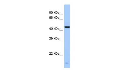 Western Blot: ZNF701 Antibody [NBP2-83899]
