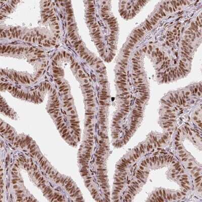 Immunohistochemistry-Paraffin: ZNF703 Antibody (CL0654) [NBP2-52940]