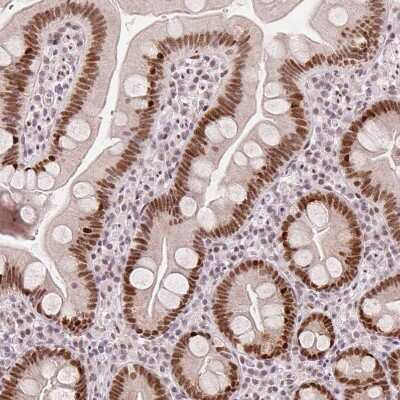 Immunohistochemistry-Paraffin: ZNF703 Antibody (CL0654) [NBP2-52940]