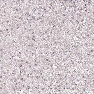 Immunohistochemistry-Paraffin: ZNF703 Antibody (CL0654) [NBP2-52940]