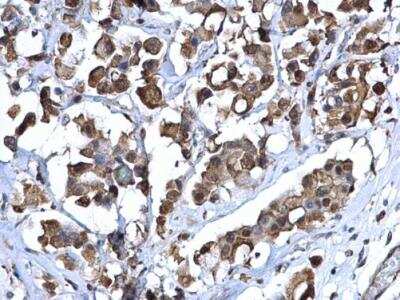Immunohistochemistry-Paraffin: ZNF703 Antibody [NBP2-21043]
