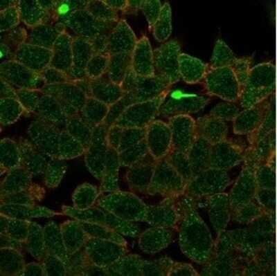 Immunocytochemistry/ Immunofluorescence: ZNF704 Antibody (PCRP-ZNF704-3C10) [NBP3-13765]