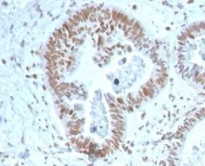 Immunohistochemistry-Paraffin: ZNF704 Antibody (PCRP-ZNF704-3C10) [NBP3-13765]