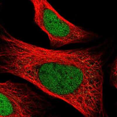 Immunocytochemistry/ Immunofluorescence: ZNF707 Antibody [NBP1-92642]