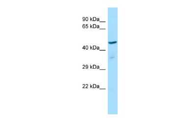 Western Blot: ZNF707 Antibody [NBP3-10517]