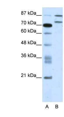 Western Blot: ZNF709 Antibody [NBP1-80164]