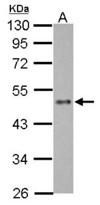 Western Blot: EZFIT/ZNF71 Antibody [NBP2-21044]