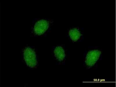 Immunocytochemistry/ Immunofluorescence: ZNF710 Antibody [H00374655-B01P]
