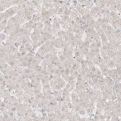 Immunohistochemistry-Paraffin: ZNF710 Antibody [NBP1-84166]