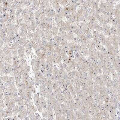 Immunohistochemistry-Paraffin: ZNF710 Antibody [NBP1-84167]