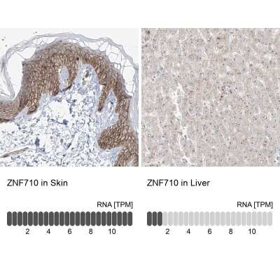 Immunohistochemistry-Paraffin: ZNF710 Antibody [NBP1-84167]