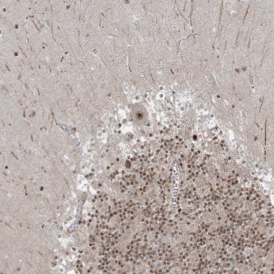 Immunohistochemistry-Paraffin: ZNF711 Antibody [NBP1-85538]