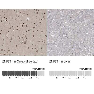Immunohistochemistry-Paraffin: ZNF711 Antibody [NBP1-85538]