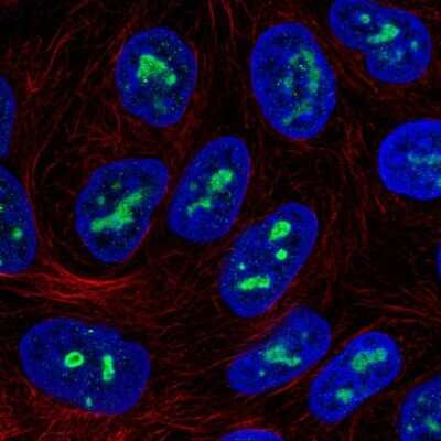Immunocytochemistry/ Immunofluorescence: ZNF713 Antibody [NBP2-56245]
