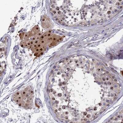 Immunohistochemistry-Paraffin: ZNF717 Antibody [NBP1-93434]