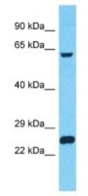 Western Blot: ZNF737 Antibody [NBP3-09926]