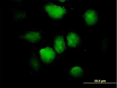 Immunocytochemistry/ Immunofluorescence: ZNF74 Antibody [H00007625-B01P]
