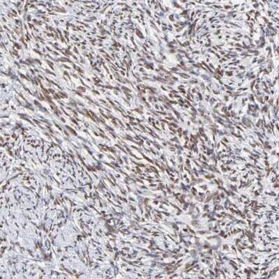 Immunohistochemistry-Paraffin: ZNF74 Antibody [NBP1-84401]