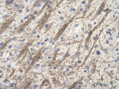 Immunohistochemistry-Paraffin: ZNF74 Antibody [NBP2-88731]