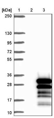 Western Blot: ZNF740 Antibody [NBP1-80602]