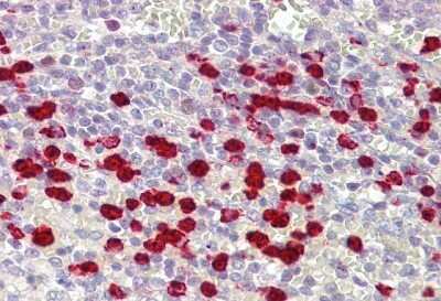 Immunohistochemistry: ZNF746 Antibody [NBP2-83901]