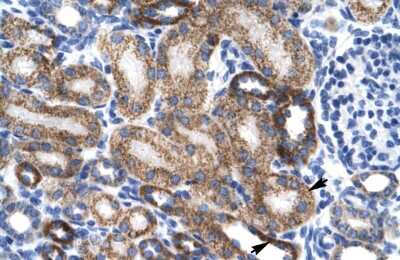 Immunohistochemistry: ZNF75 Antibody [NBP2-83903]
