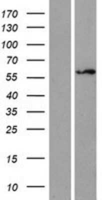 Western Blot: ZNF75 Overexpression Lysate [NBP2-10382]