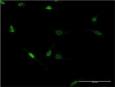 Immunocytochemistry/ Immunofluorescence: ZNF76 Antibody (3D4) [H00007629-M06]