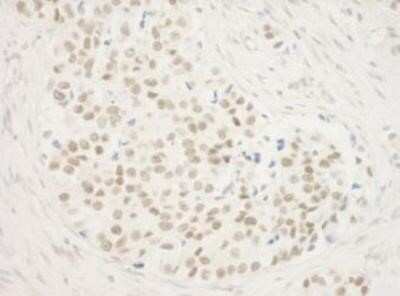 Immunohistochemistry: ZNF768 Antibody [NBP1-78220]
