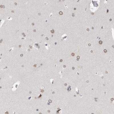 Immunohistochemistry-Paraffin: ZNF770 Antibody [NBP1-82172]